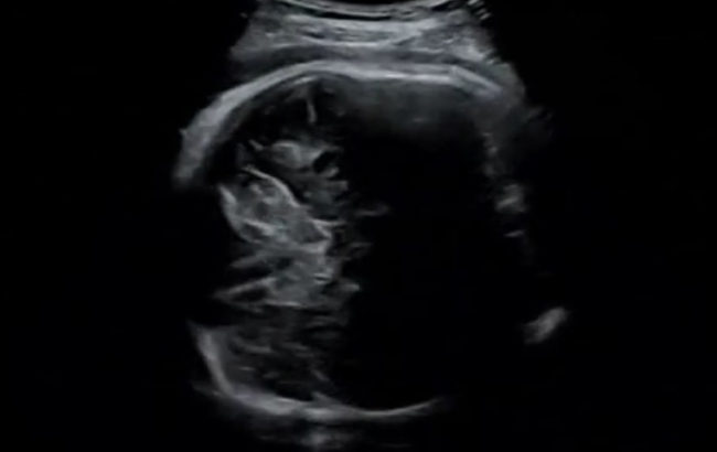 産後ケアのために